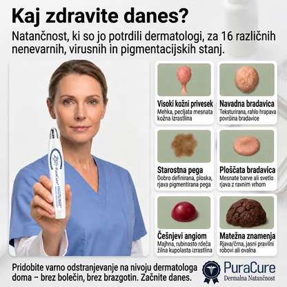 PuraCure®👩‍⚕️ Rezultati so vidni že v 7 dneh! Valjček za odstranjevanje bradavic in drugih kožnih težav | Neboleče in minimalno razmaže.