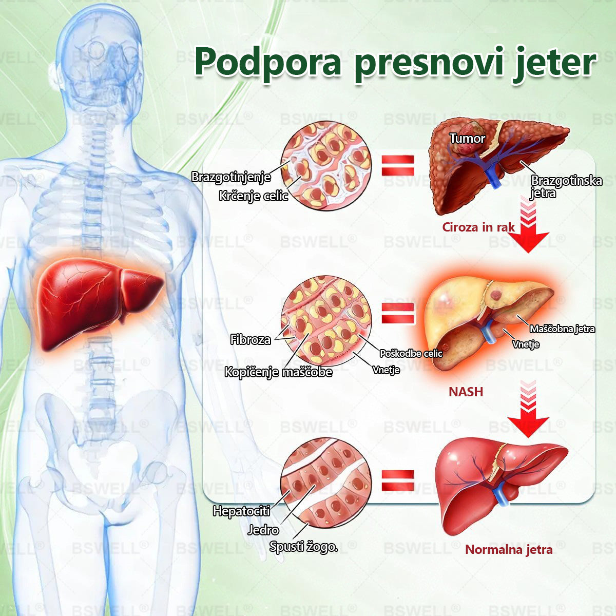 🔥🔥🔥🔥🔥BSWELL® Nano mikroneedling shujševalni obliž (Samo enkrat na dan, vidne spremembe v 28 dneh)  ✅ Za debelost, zdravje srca in ožilja, sladkorno bolezen, spalno apnejo, zdravje črevesja, težave s sklepi in še več.