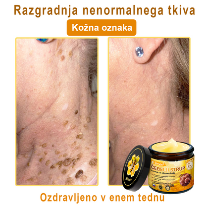 📢📢📢📢Sinvie® krema s čebeljim strupom | 50 ml | Profesionalna formula za nego in obnovo kože