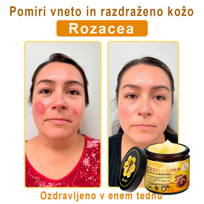 📢📢📢📢Sinvie® krema s čebeljim strupom | 50 ml | Profesionalna formula za nego in obnovo kože