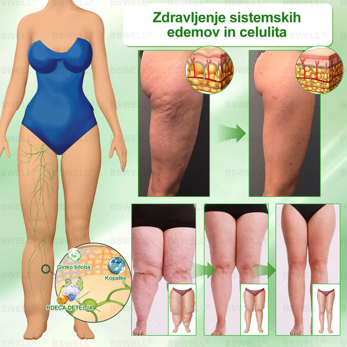 🔥🔥🔥🔥🔥BSWELL® Nano mikroneedling shujševalni obliž (Samo enkrat na dan, vidne spremembe v 28 dneh)  ✅ Za debelost, zdravje srca in ožilja, sladkorno bolezen, spalno apnejo, zdravje črevesja, težave s sklepi in še več.