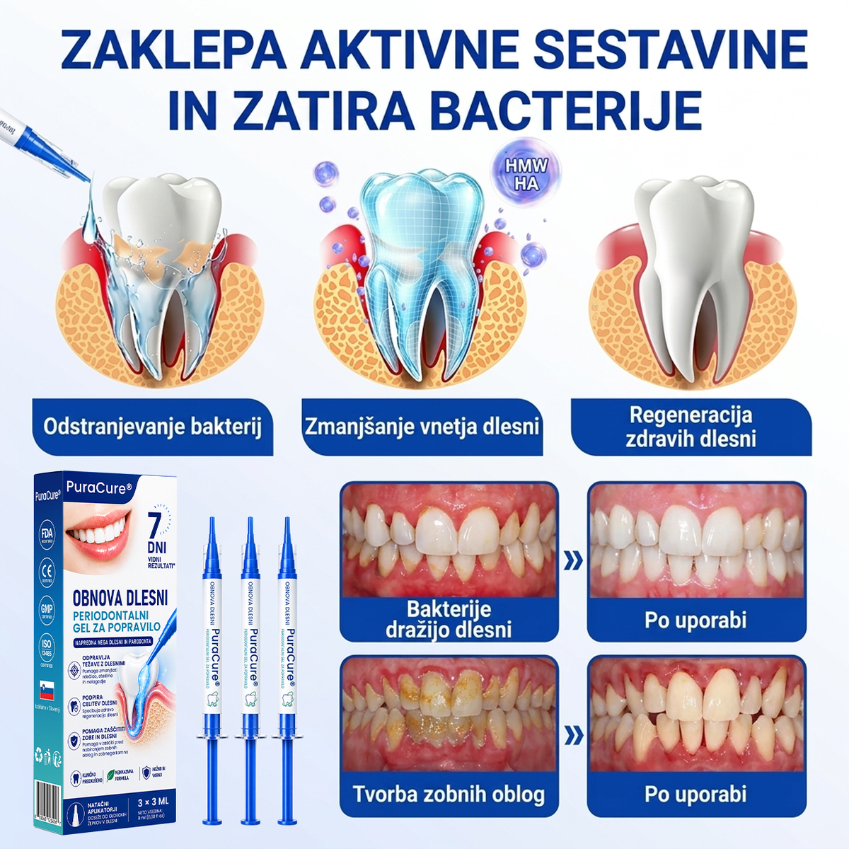 🇸🇮👨‍⚕️✅🦷 PuraCure® OBNOVITVENI GEL ZA DLESNI – Parodontalni obnovitveni gel🧂