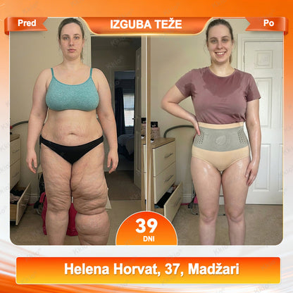 📢 Odkrij TikTok trend – nova Kkio®👩 4 serija 1️⃣ Kratke hlače za preoblikovanje telesa in izgubo maščobe, 2️⃣ Mikro kratke hlače z Moringo in Berberinom ☘️ ✅ Na voljo samo v uradni spletni trgovini | Originalni izdelek