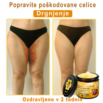 📢📢📢📢Sinvie® krema s čebeljim strupom | 50 ml | Profesionalna formula za nego in obnovo kože