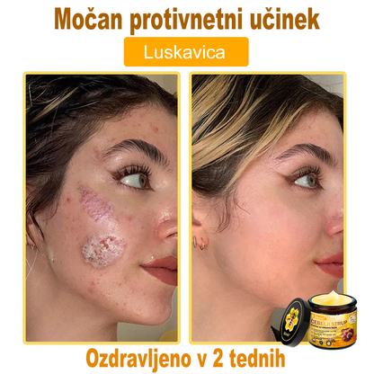 📢📢📢📢Sinvie® krema s čebeljim strupom | 50 ml | Profesionalna formula za nego in obnovo kože