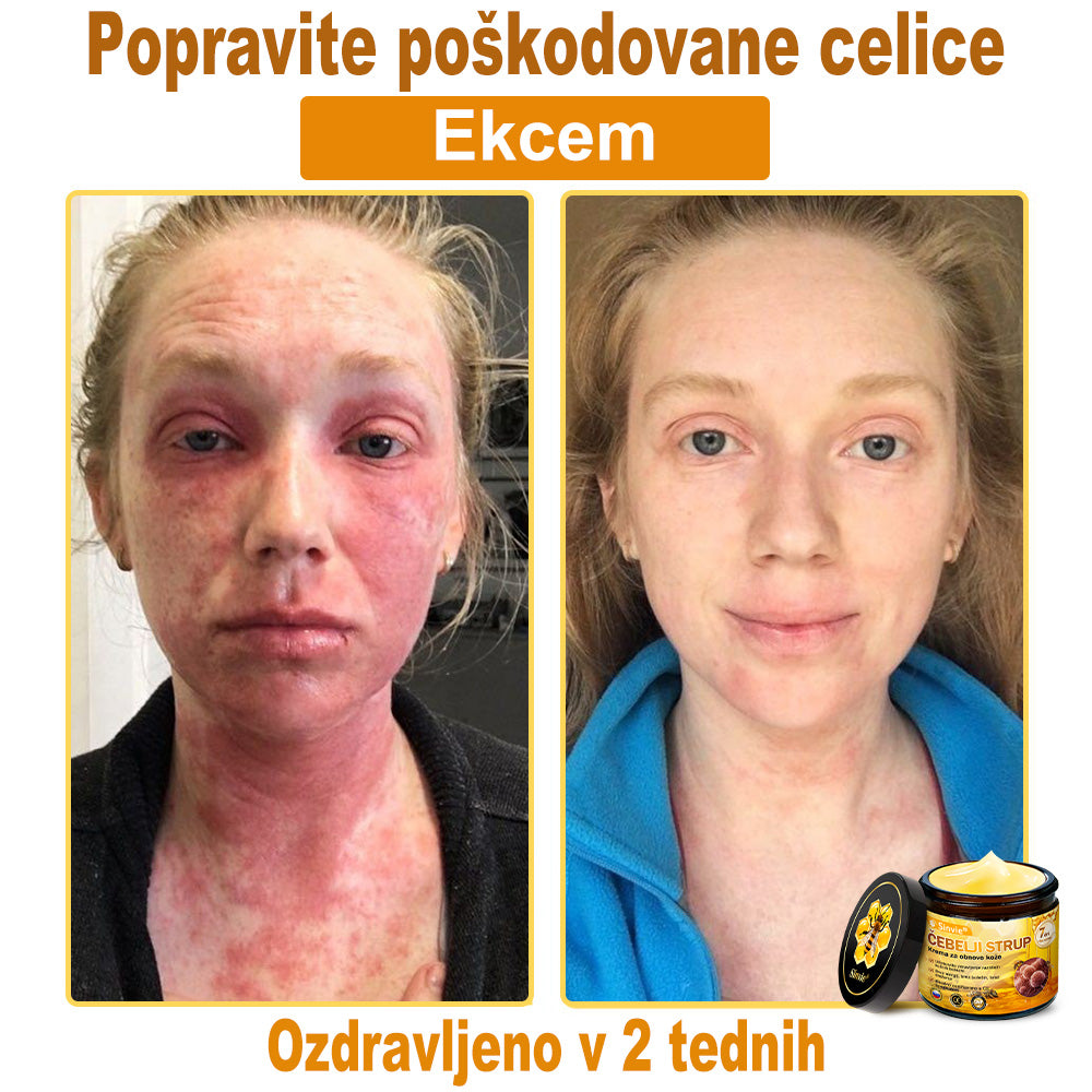 📢📢📢📢Sinvie® krema s čebeljim strupom | 50 ml | Profesionalna formula za nego in obnovo kože