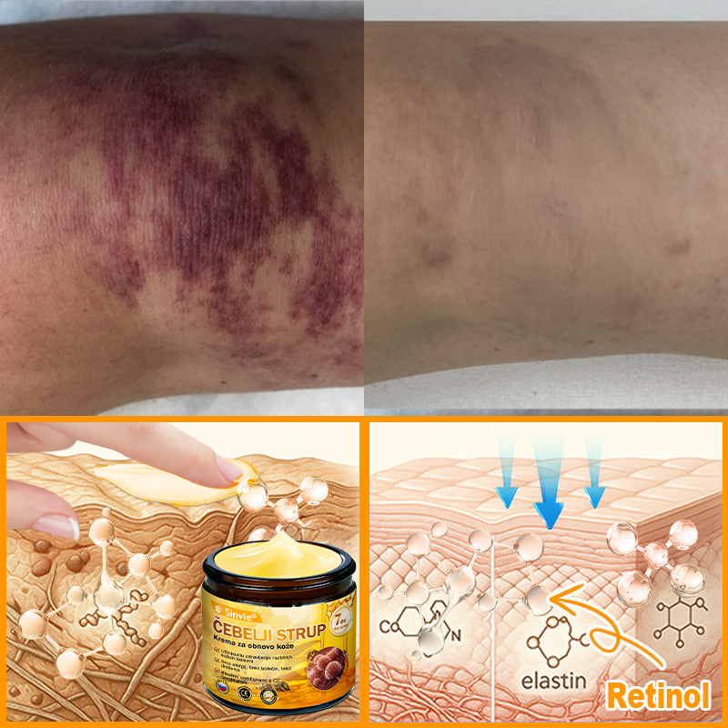 📢📢📢📢Sinvie® krema s čebeljim strupom | 50 ml | Profesionalna formula za nego in obnovo kože