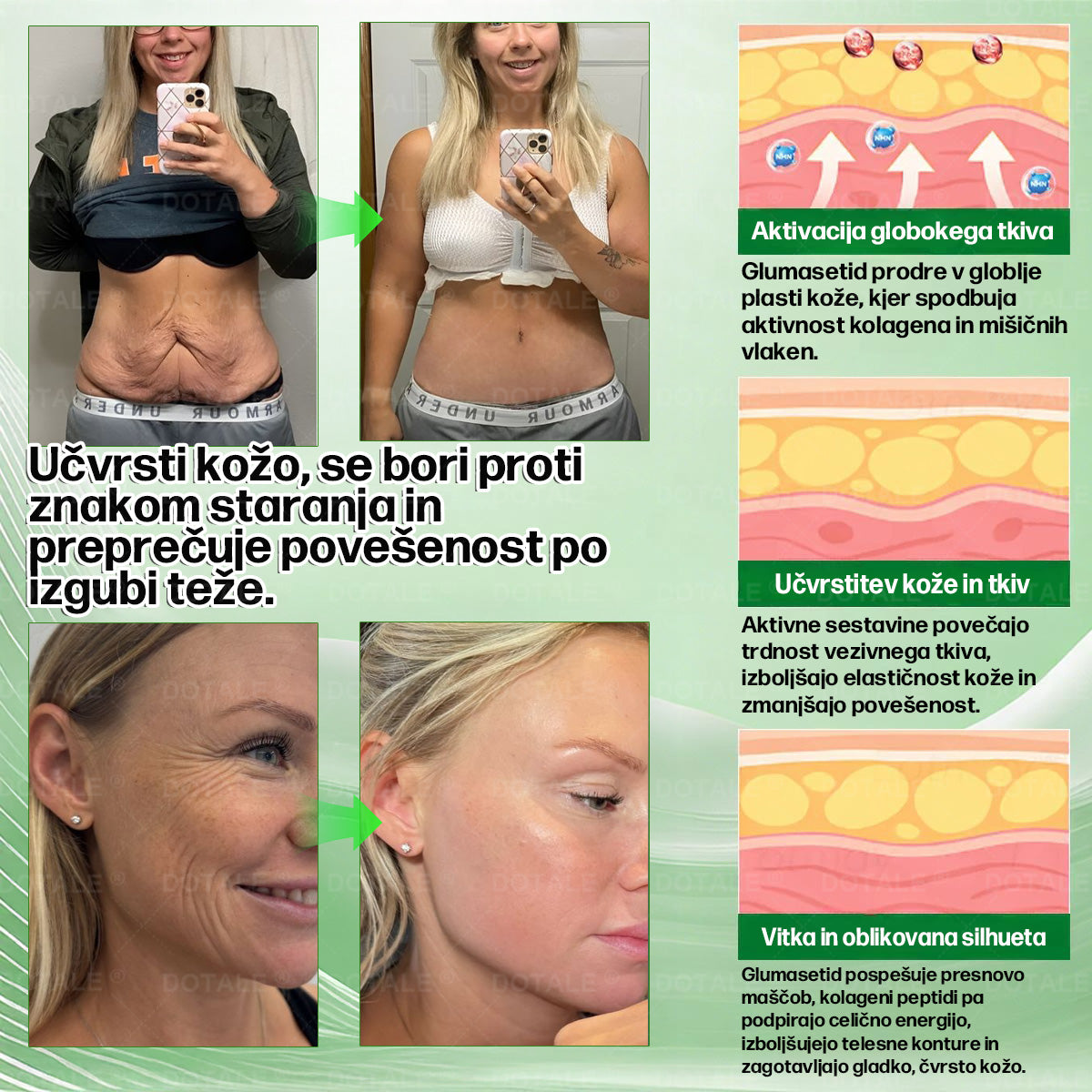 🔥🔥🔥🔥🔥BSWELL® Nano mikroneedling shujševalni obliž (Samo enkrat na dan, vidne spremembe v 28 dneh)  ✅ Za debelost, zdravje srca in ožilja, sladkorno bolezen, spalno apnejo, zdravje črevesja, težave s sklepi in še več.