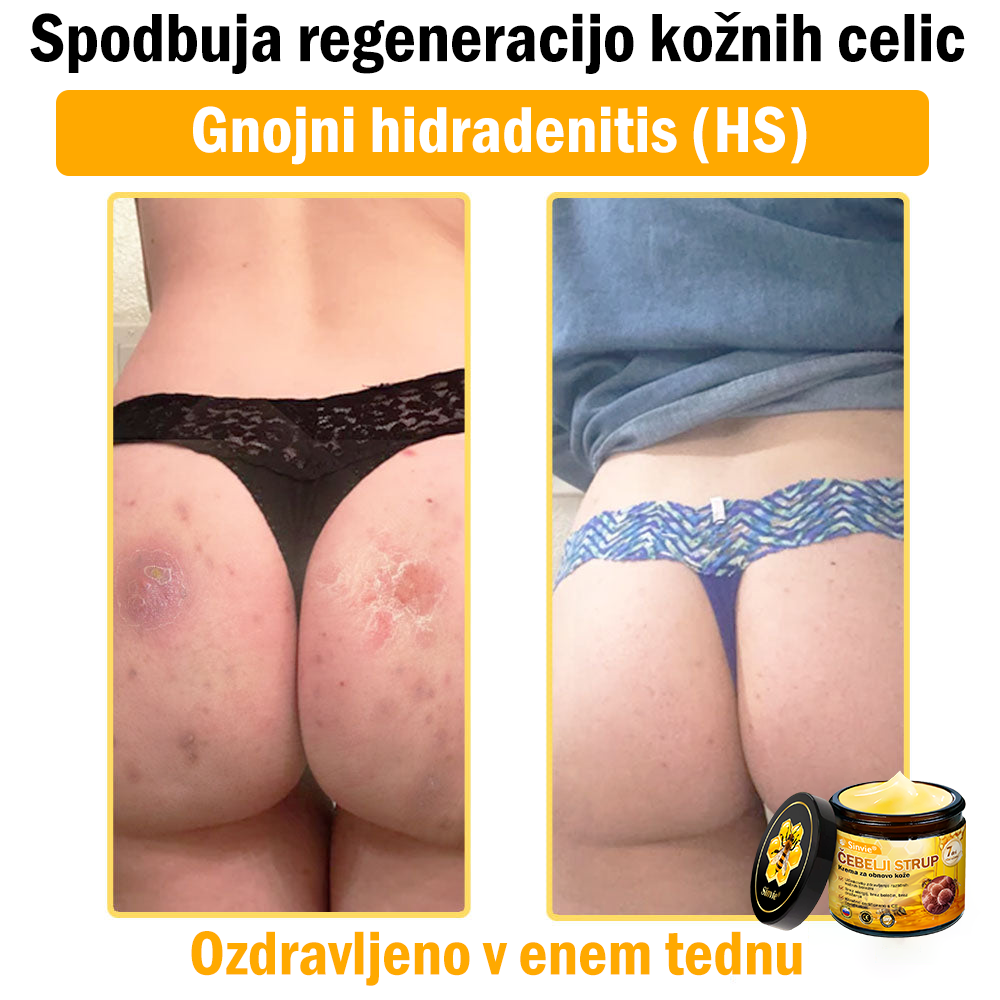 📢📢📢📢Sinvie® krema s čebeljim strupom | 50 ml | Profesionalna formula za nego in obnovo kože
