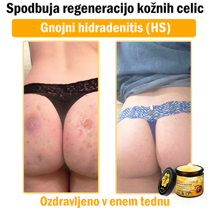 📢📢📢📢Sinvie® krema s čebeljim strupom | 50 ml | Profesionalna formula za nego in obnovo kože
